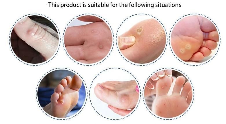 Medical Corn Plaster Corn Remover Foot Pads Removal Plaster
