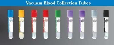 Quality CE Certified vacuum Blood Collection Tube Factory Direct