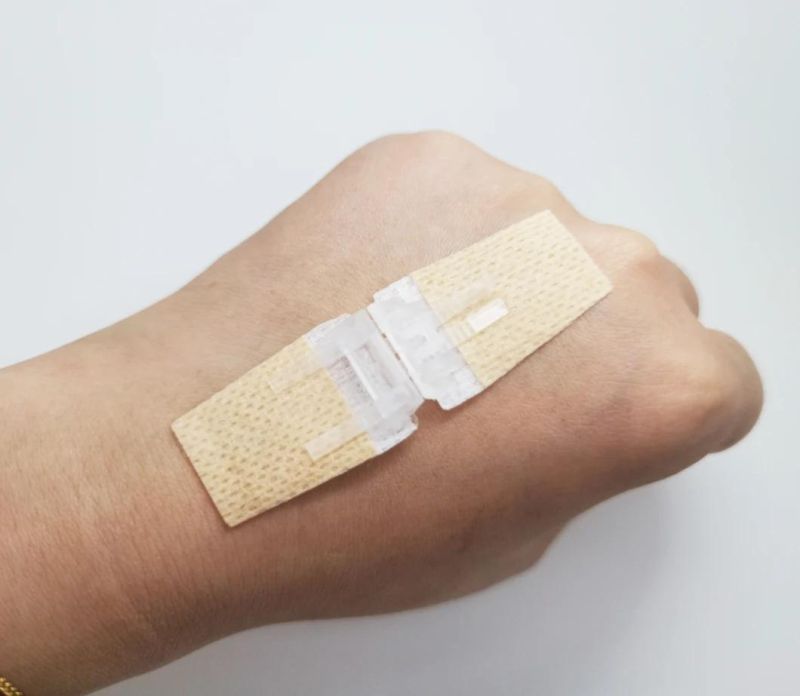 Surgical Wound Closure Plaster, Adhesive Wound Closure Device