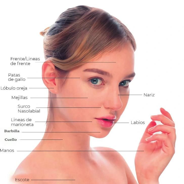 Dermal Filler Hyaluronic Acid Gel for Nose Augmentation