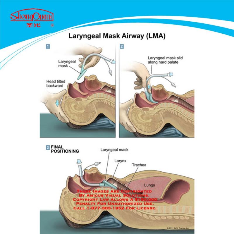 CE Approved Manufacturer Laryngeal Mask Airway