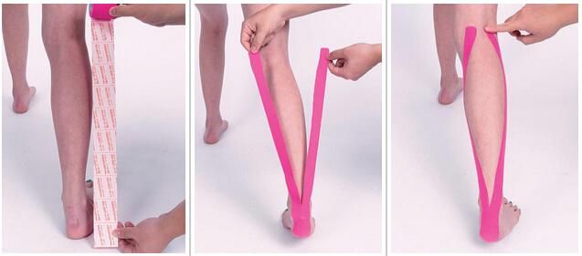 Kinesiology Tape Designed to Give You Pain Relief Muscle Support