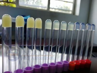 Laboratory Consumables Serum Separation Gel
