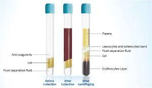 High Concentration Platelet Rich Plasma Prp Tube CPT Tube