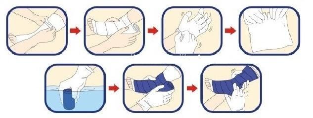 Medical Dressing Fiberglass Soft Waterproof Cast Orthopedic Casting Tape Medical Ortho Fiberglass Casting Tape