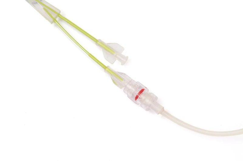 Reborn Medical Ureteral Balloon Dilatation Catheter Solve Theurinary Obstruction with CE Certificate