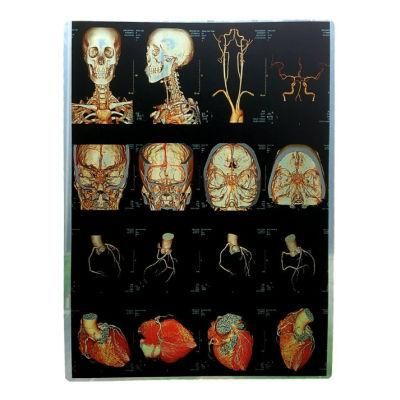 8X10 A3 A4 Pet Radiology/ Ultrasound 180um Blue Inkjet/Laser Medical X-ray Film