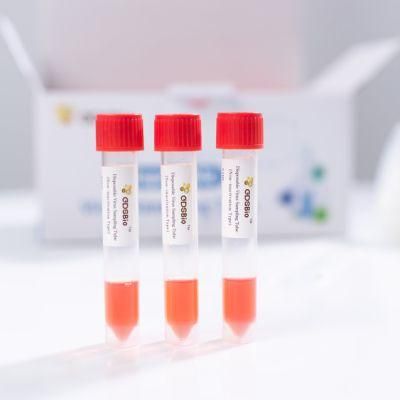 Nylon-Flocked Swab Disposable Sampling Tube Virus Transport Medium Vtm