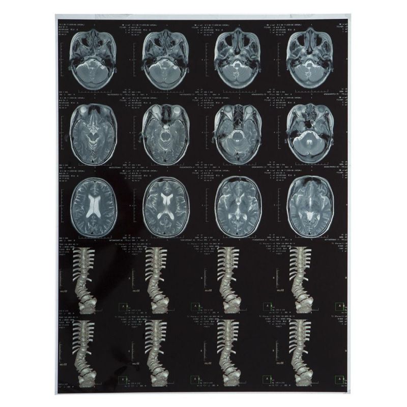 Blue and White Dry Ultrasound Films