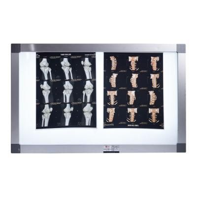 Laser X Ray Blue Film 10X40cm for CT Scan