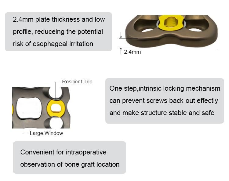 Orthopedic Implants Anterior Cervical Plate-II for Spinal Surgery