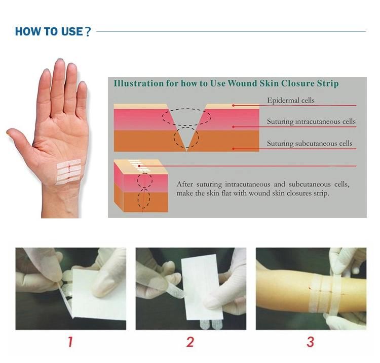 New Arrival Disposable Wound Skin Closure Strip for Wound Skin Close Care