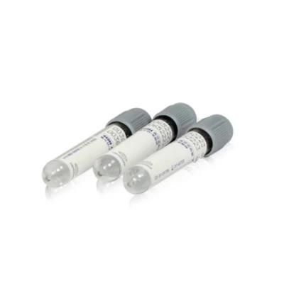 Cheap Price Vacuum Glucose Tube Sodium Fluoride Blood Tube Grey Top Tube in Lab