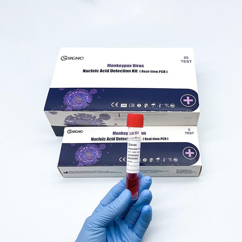 Factory Price Viru Nucleic Acid Detection Kit PCR Antigen Molecular Biology Reagent Monkeypox Test